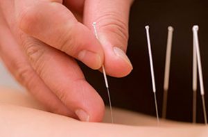 Evergreen Chinese Medical Centre Acupuncture