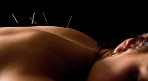 Evergreen Chinese Medical Centre Acupuncture